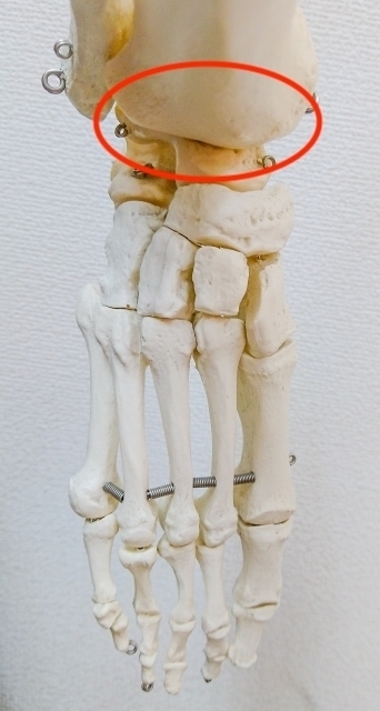 変形性足関節症の専門治療 足の専門 東京ポダイアトリークリニック 東京都港区