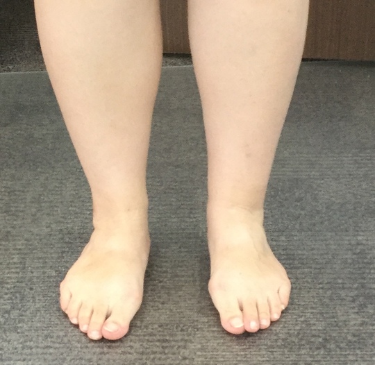 くるぶし内側の痛みの治療なら 足の専門 東京ポダイアトリークリニック 東京都港区